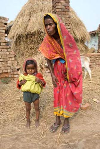 Young and Old All Can Suffer Reportage India Bihar Rural Lifestyle_DSC0161   Child and Lady suffering from Fluorosis 