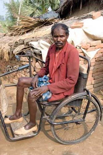Too Much Fluoride_DSC0145 DVD India Bihar Rural Lifestyle Man  suffering from Fluorosis 