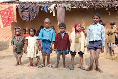 What Does Their Future Hold _DSC0124 DVD India Bihar Rural Lifestyle Children suffering from Fluorosis 